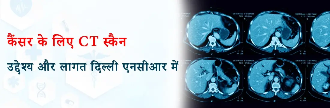 कैंसर के लिए CT स्कैन: उद्देश्य और लागत दिल्ली एनसीआर में।